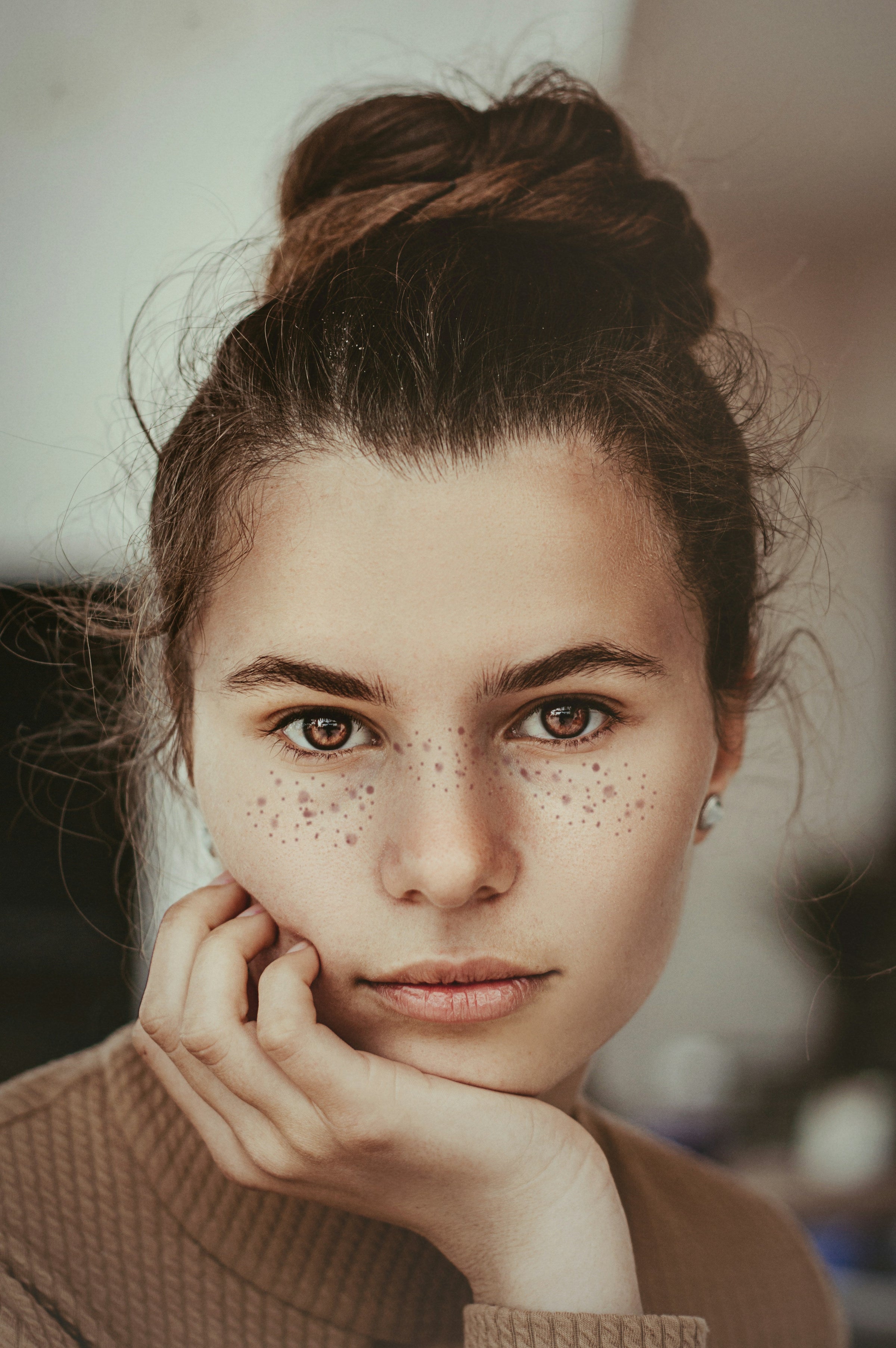 Acne Prone Skin