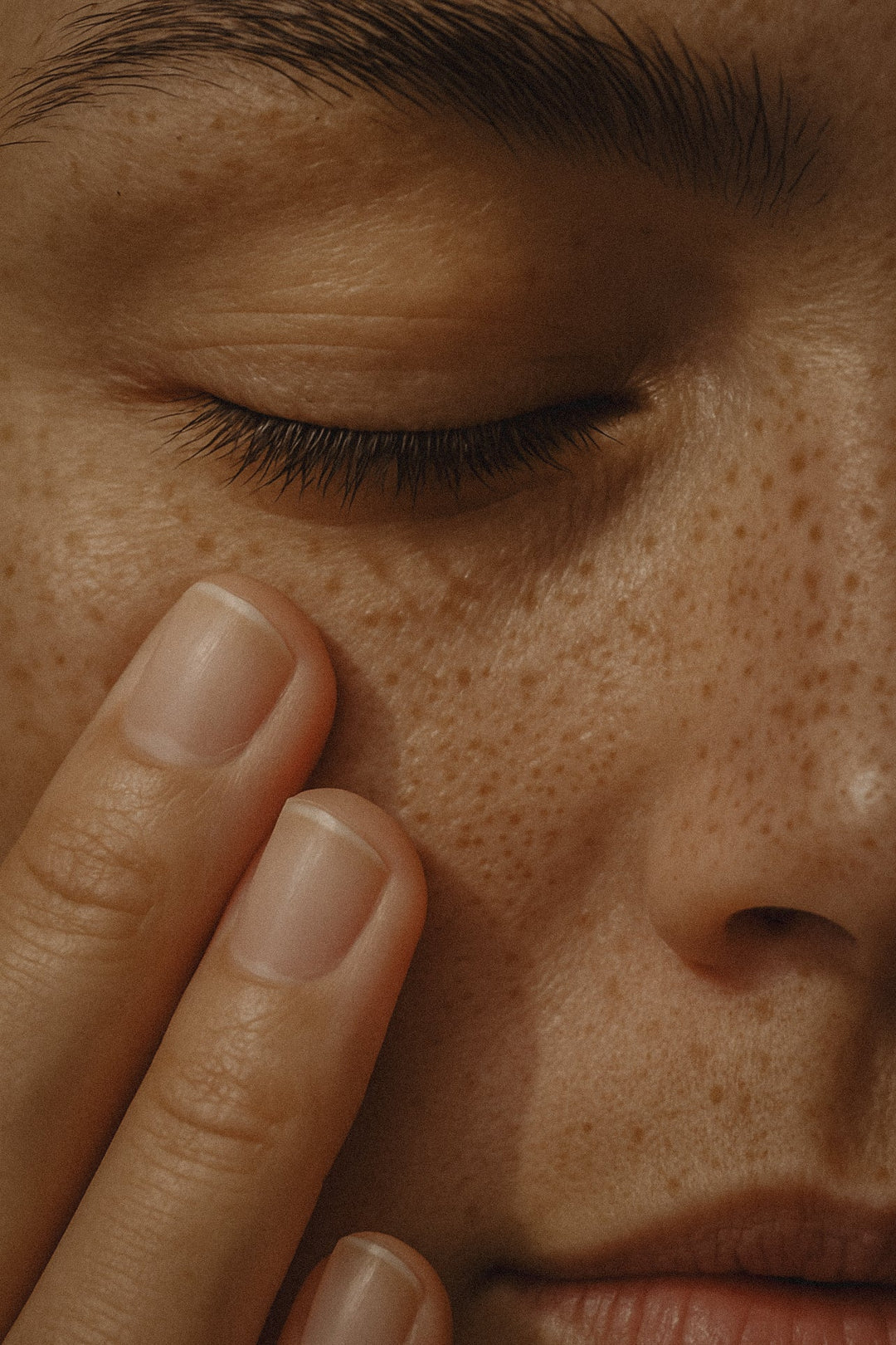 Retinol Peeling vorher nachher – Hautschälung und Rötung als typische Nebenwirkung von Retinol