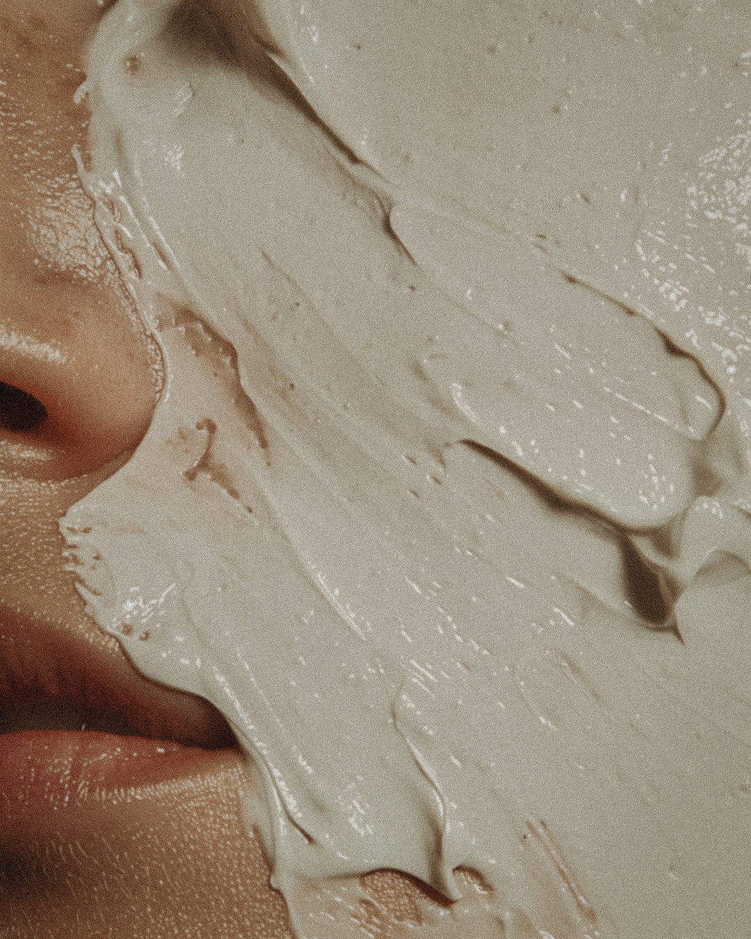 Pigmentstörung Gesicht – Melasma und Hyperpigmentierung erkennen und behandeln