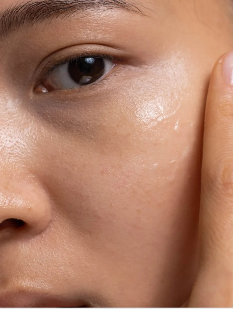 Niacinamide Moisturiser