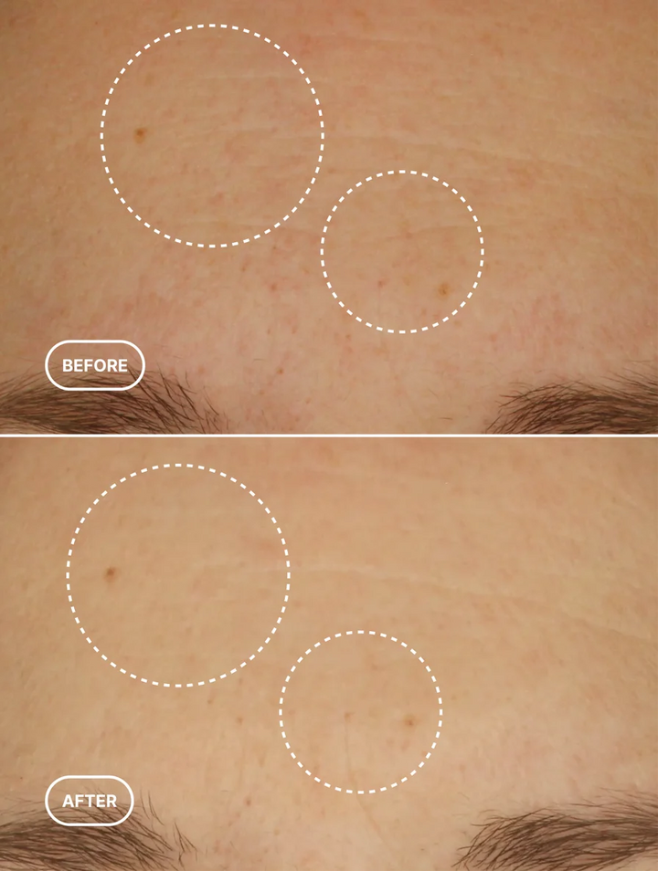 Retinol Alternative Moisturiser